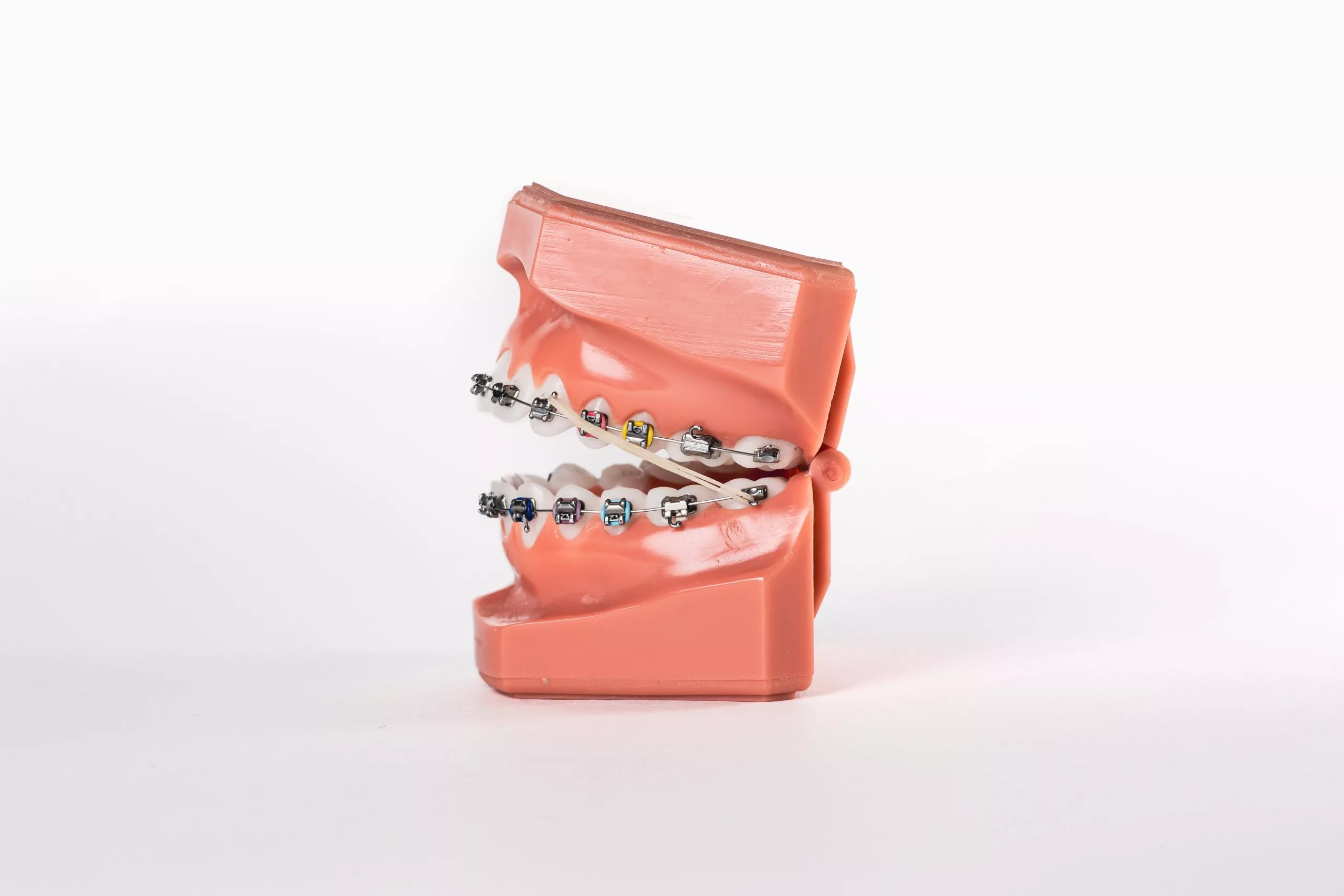 Slotjesbeugel los? Ortho Westland helpt je. - fotozee Slotjesbeugel los? Ortho Westland helpt je. - fotozee